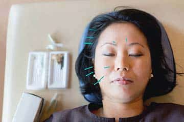 Acupuncture in Singapore
