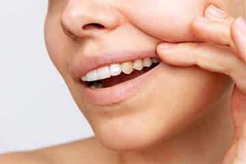 Natural Tooth Care: 5 Best Tips
